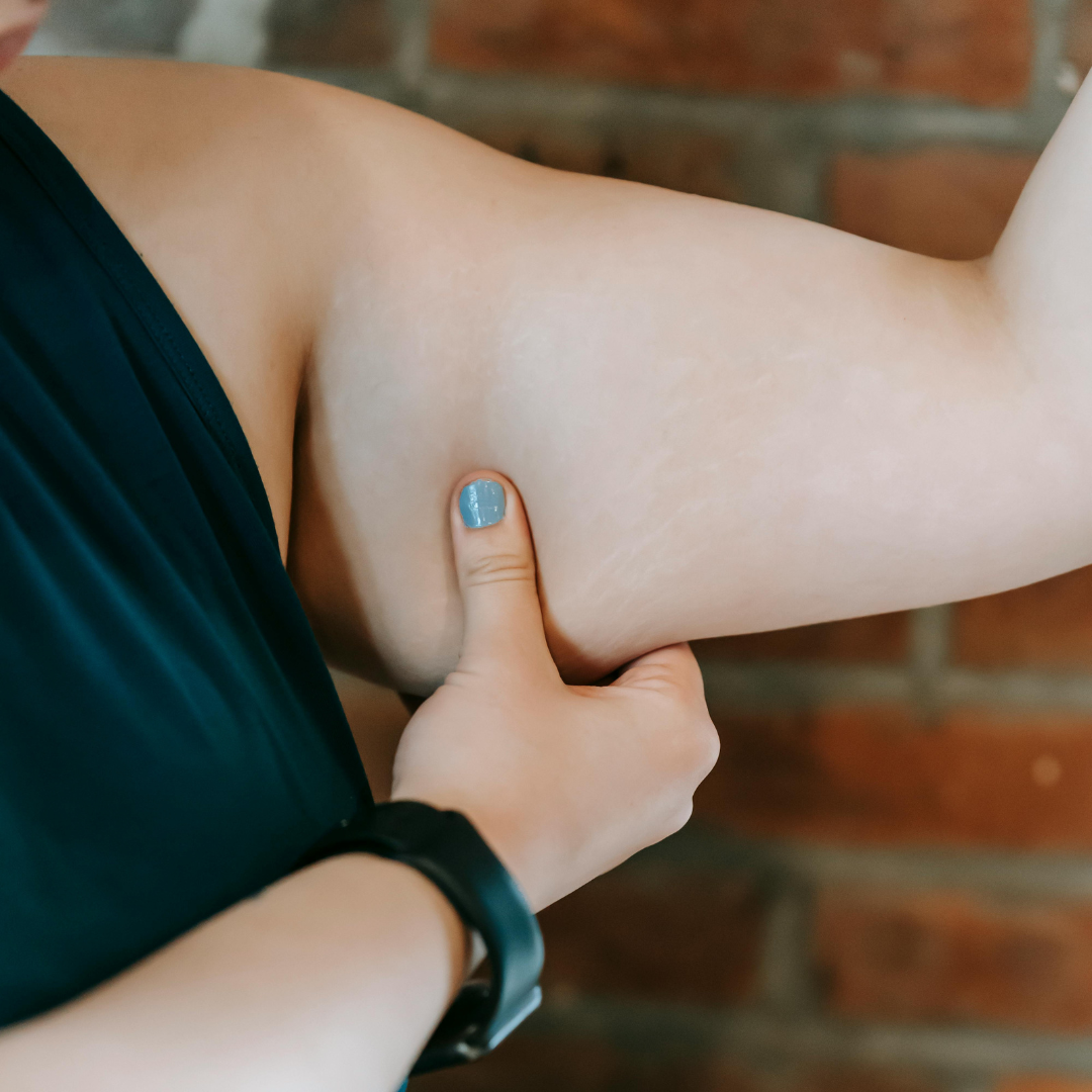 Overcoming Challenges in Weight Management